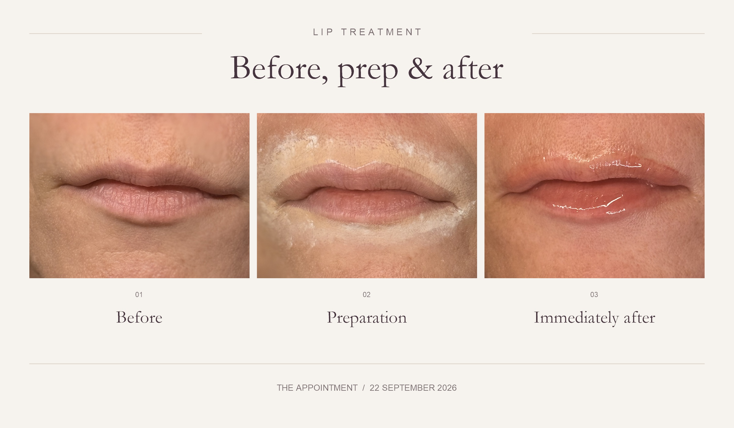 Lip Blush treatment on 22 September 2026: lips before treatment, during preparation, and immediately after treatment, shown side by side.